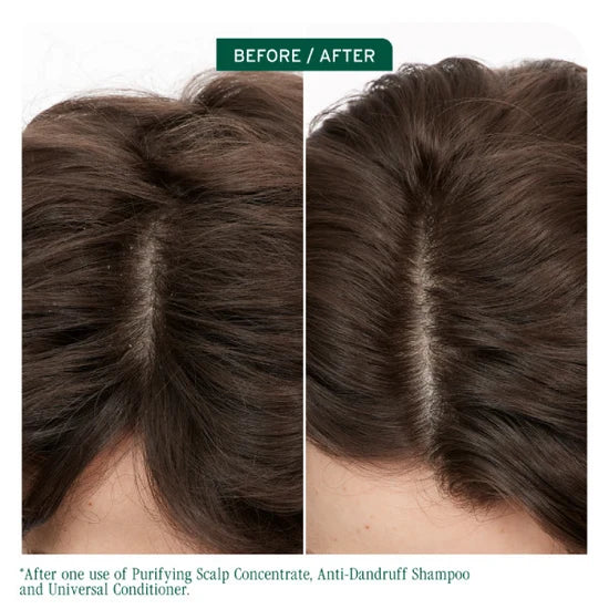 Biolage Scalp Sync Anti-Dandruff Shampoo