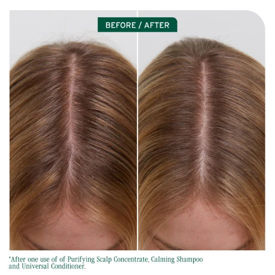 Biolage Scalp Sync Universal Conditioner